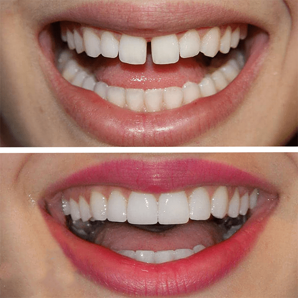 Hollywood smile Clinic