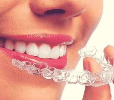 best orthodontist in dubai