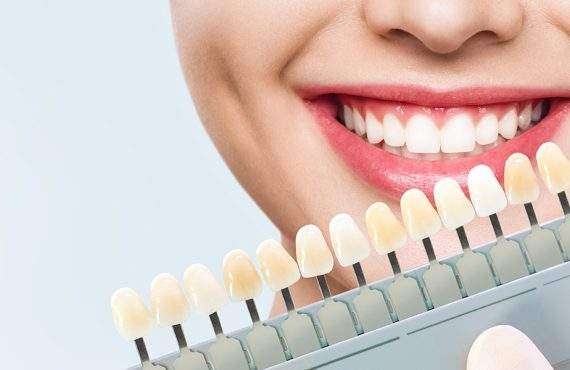 best teeth whitening in dubai