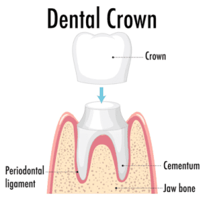 infographic-human-dental-crown_1308-93182 (1) human-dental-crown
